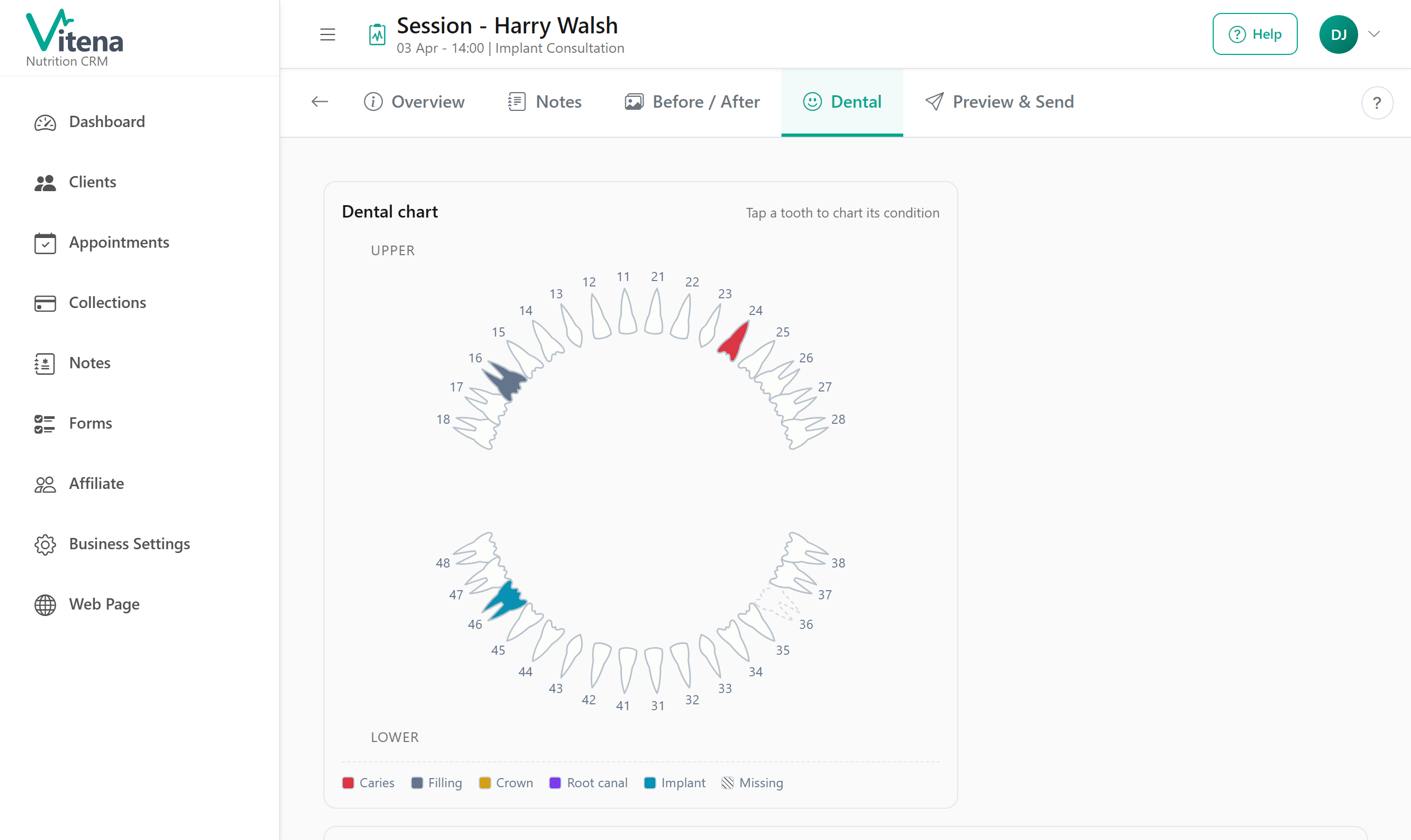 Screenshot of session dental