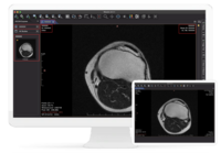 Screenshot of DICOM data redaction solutions.